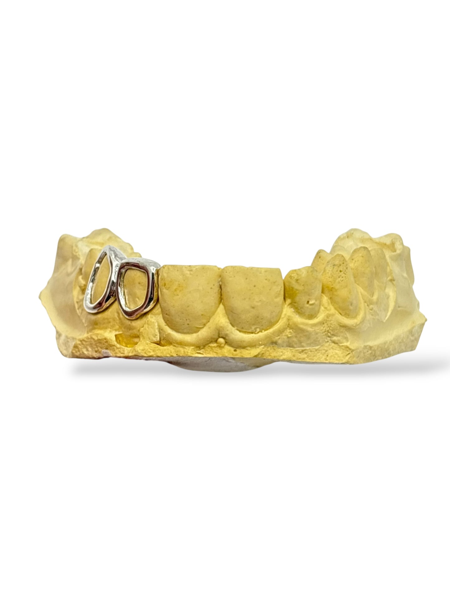 STERLING SILVER TWO WINDOW CAP GRILLZ